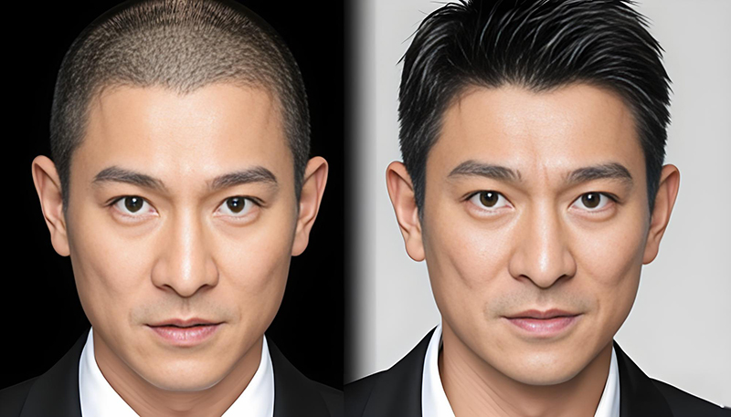🆚假发VS生发:哪种更适合严重脱发?真实对比帮你选!