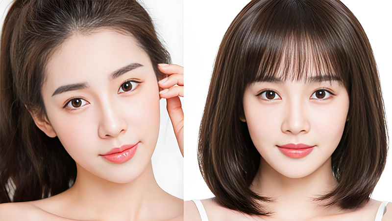 🤖发际线后移严重?试试自然逼真的补发,多少钱能搞定?