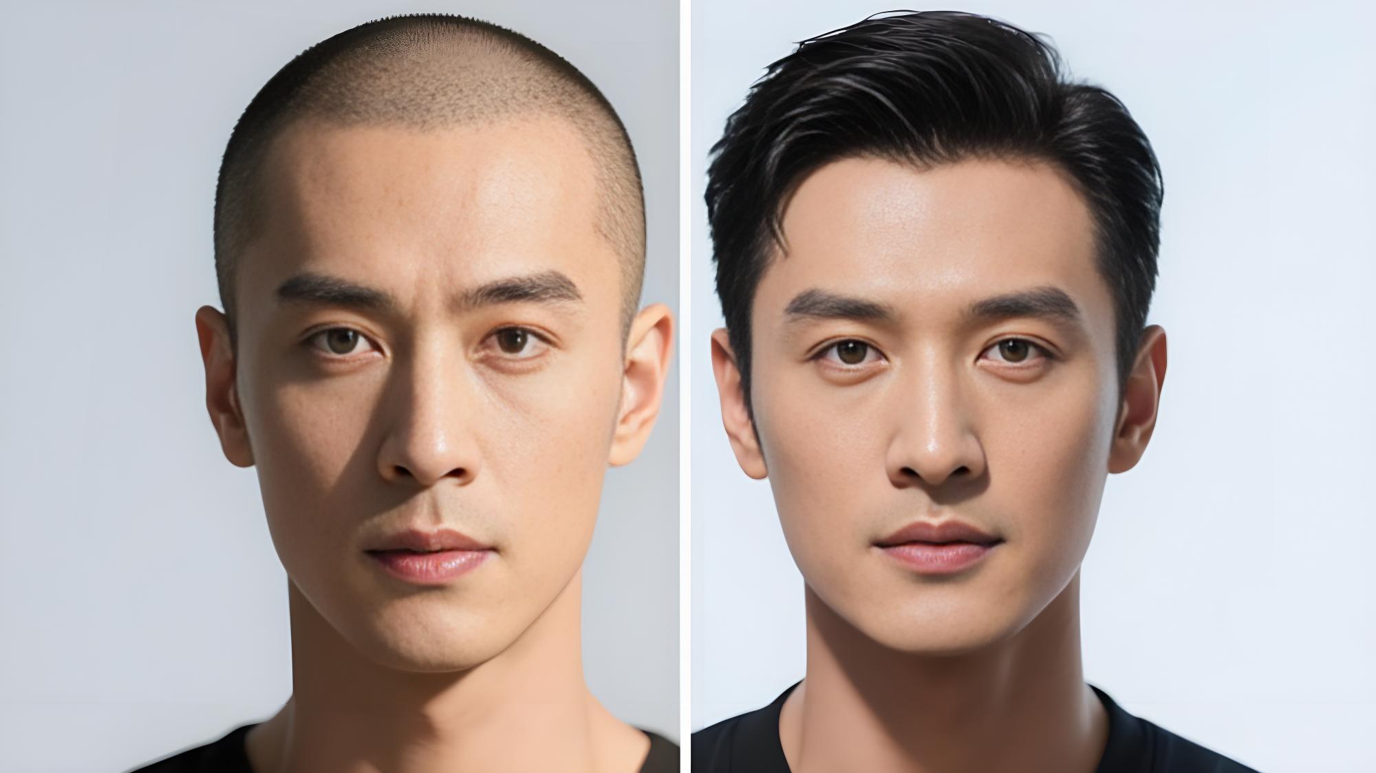 🀢M型发际线克星!真人发丝假发定制还原原生发流