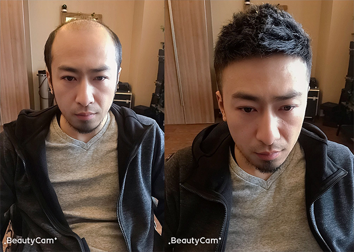 头发掉的严重怎么办?科学防脱全攻略,从根源改善掉发困扰💡