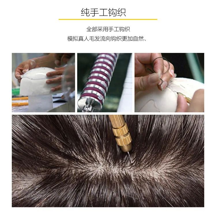 男士假发粘胶的好还是套头的好？先按脱发面积选，再看牢固与自然度